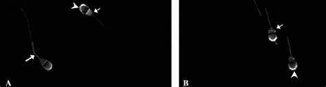 Immunolocalization of Na þ K þ ATPase in bovine spermatozoa The Na þ