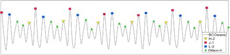 Heart Rate Detection Method Based On Ballistocardiogram Signal Of