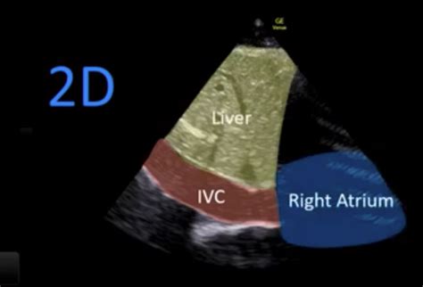 Lecture Ultrasound Modalities Openanesthesia