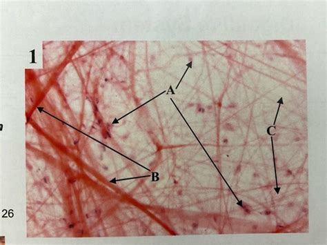 Histology Connective Tissue Lab BYU Flashcards Quizlet