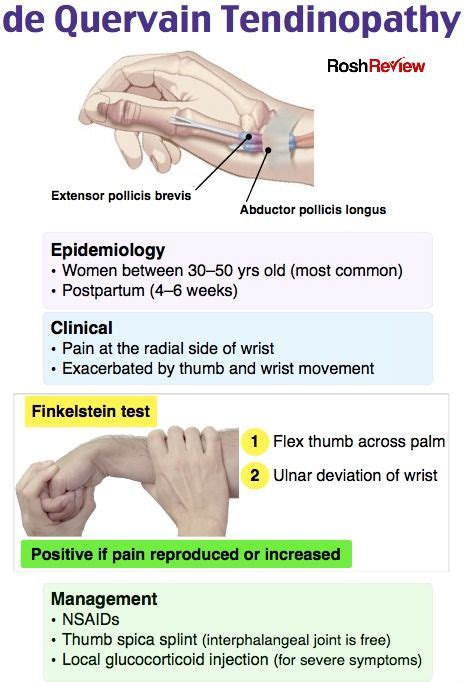 de Quervain Tendinopathy | Medical anatomy, Medicine, Medical knowledge