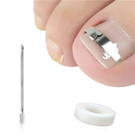 Buy Ingrown Toenail Pedicure Tool Straightening Clip Curved Brace