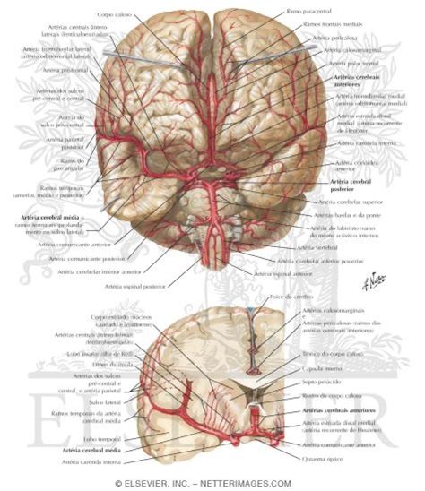 Arteria Espinal Anterior