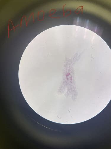 Lab Protozoa Flashcards Quizlet