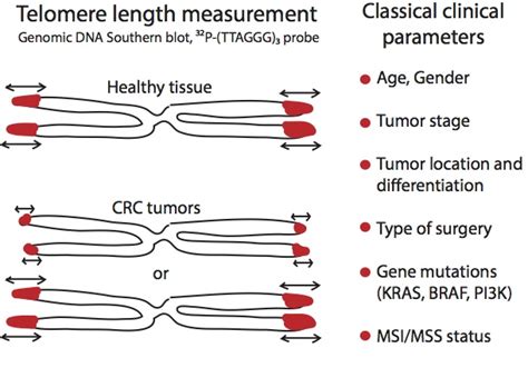 Ijms Free Full Text Measurement Of Telomere Length In Colorectal