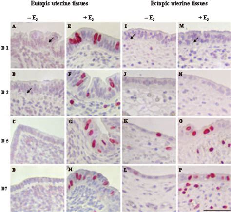 Cell Proliferation In Eutopic And Ectopic Uterine Tissue Uterine Download Scientific Diagram