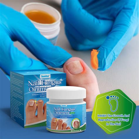 Antibacterial Cream Anti Fungal Cream Nail Fungus Treatment Plus