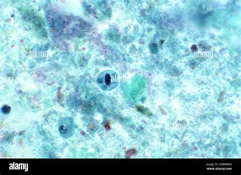 This Trichrome Stained Photomicrograph Revealed Some Of The Ultrastructural Features Exhibited