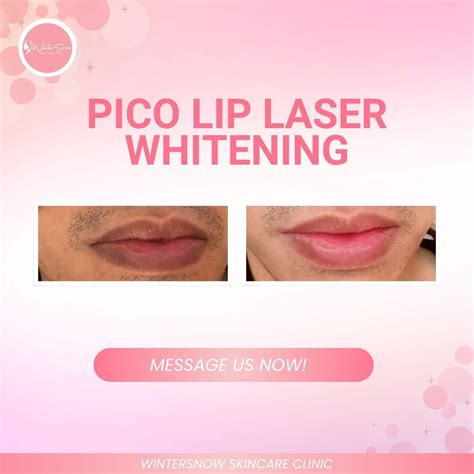 goodbye winter snow skin care clinic taytay rizal facebook