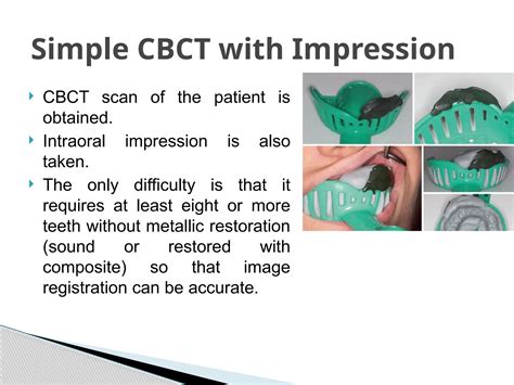 15. guided endodontics important for dental students | PPTX