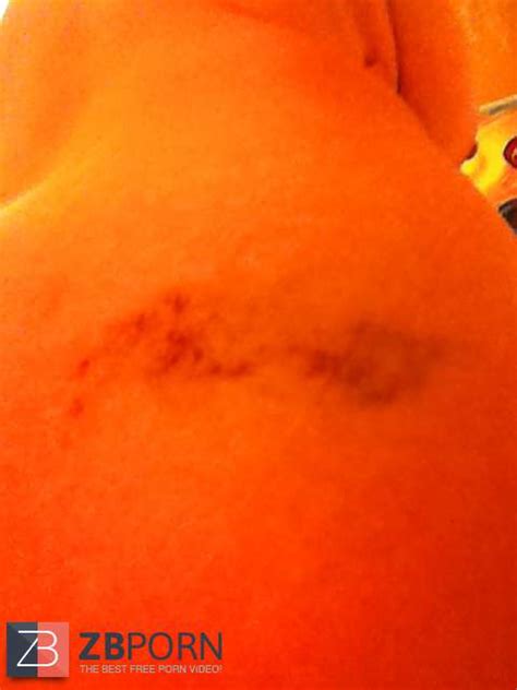 Various Photos Of Her Smacked Backside ZB Porn