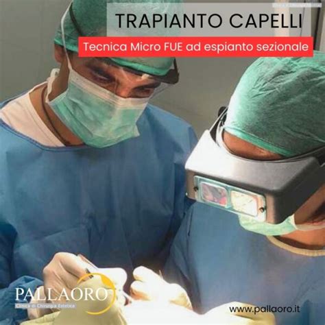 Trapianto Capelli Micro Fue Autotrapianto Capelli Clinica Pallaoro