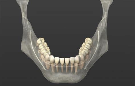 The Connection Between Jawbone Grafting And Dental Implants Fort