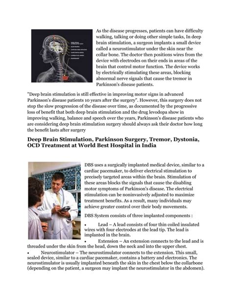 Deep Brain Stimulation Procedure For Parkinsons Control Dbs For Parkinsons Disease Treatment