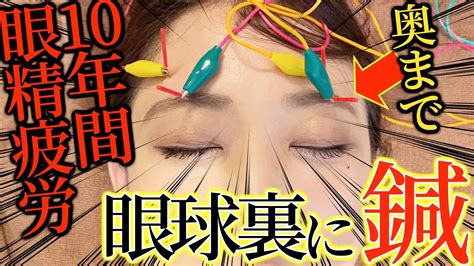 【視力改善 整体】最悪10年の眼精疲労、スマホ老眼、視力低下の目の奥を鍼で刺激し治す【東京銀座 横浜元町 鍼灸】 Youtube