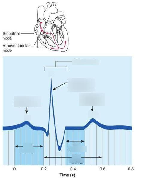 the normal electrocardiogram Diagram | Quizlet