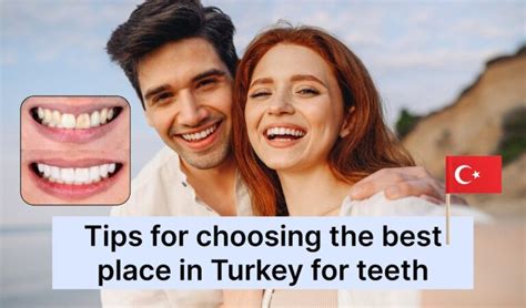 Choosing The Best Place In Turkey For Teeth Findglob