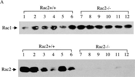 Rac Protein Expression And T Cell Development In Rac2 And Rac2