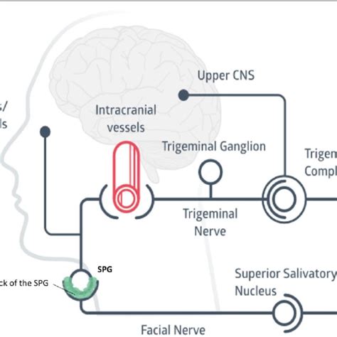 Diagram Showing The Involvement Of The Sphenopalatine Ganglion Spg In