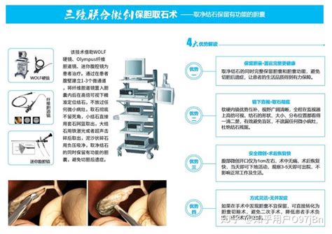 云南有没有三镜联合微创保胆取石这个手术是怎么做的 知乎