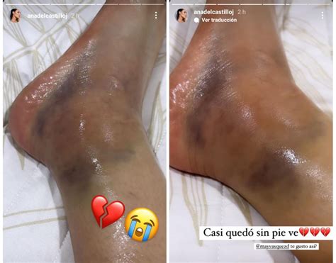 Video Ana Del Castillo Pidió Ayuda De Sus Seguidores Para Dejar De Tomar Otros Cuatro Meses