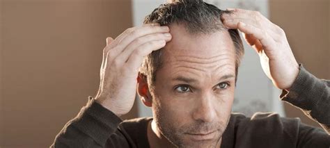 Thinning Hair 3 Remedies That Actually Work San Diego Men S Salon