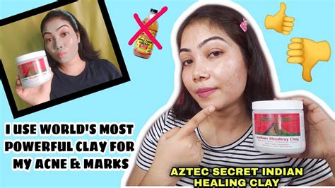 Aztec Clay Mask Reviewaztec Secret Indian Healing Clay Mask Reviewaztec Healing Clay For Acne