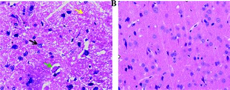 Hematoxylin And Eosin H E Staining Of Brain Tissue Sections Of Rat