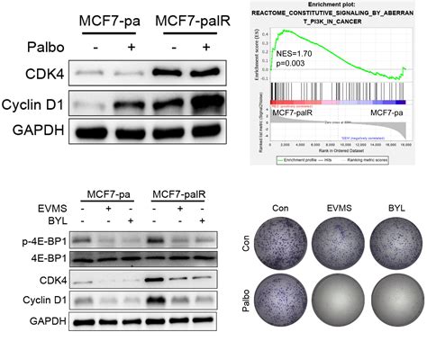 Overexpressed Cyclin D And Cdk Proteins Are Responsible For The