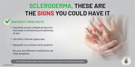 Scleroderma Skin Symptoms