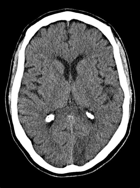 Detail Contoh Hasil Ct Scan Koleksi Nomer 49