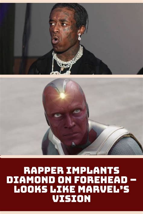 Rapper Implants Diamond On Forehead Looks Like Marvel’s Vision