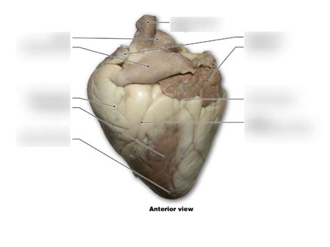 Real Heart Anterior Diagram Quizlet