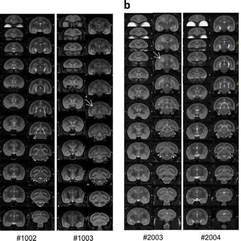 MRI white matter lesions in each marmoset. White matter T2-hyperintense ...