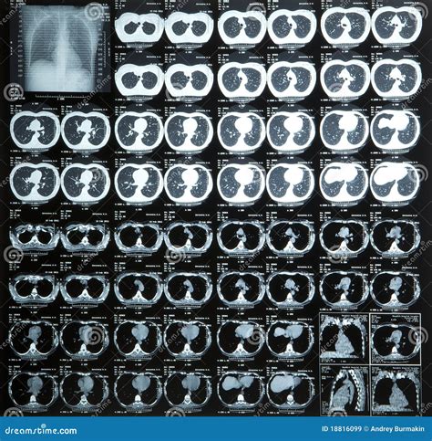 Closeup Of A CT Scan Stock Image Image Of Clinical Head 18816099