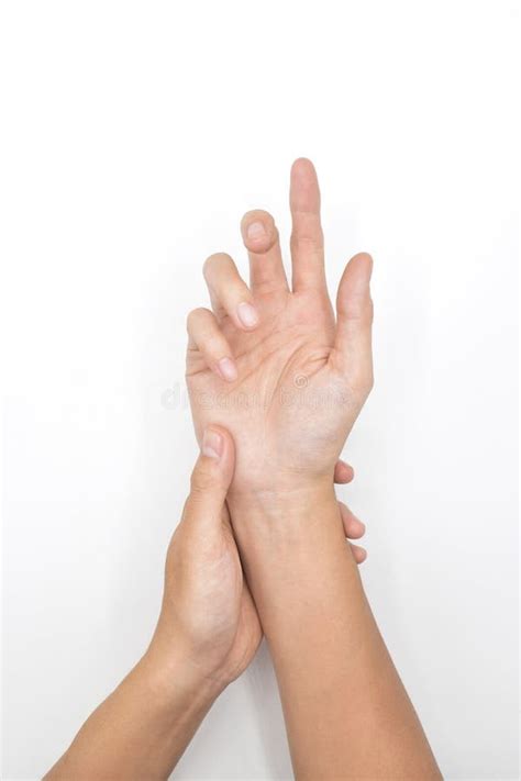 Ulnar Claw Hand Of Asian Young Man Also Known As Spinster Claw Stock