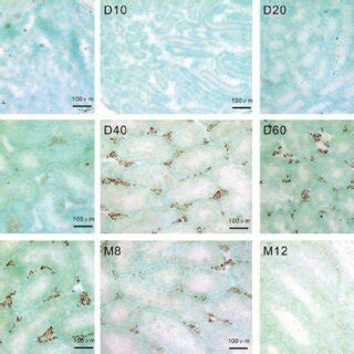 Pathology Of Testes In Induced Cryptorchidism And Busulfan Treated