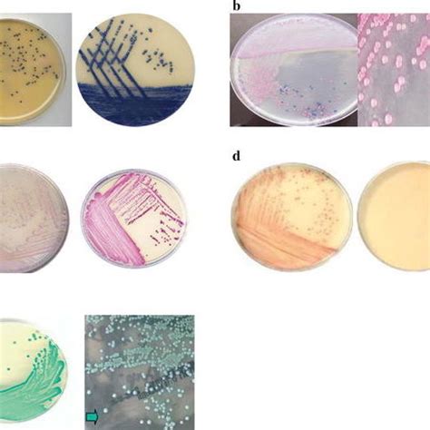 The Morphology Of Mrsa Colonies In Different Chromogenic Media A Oxoid