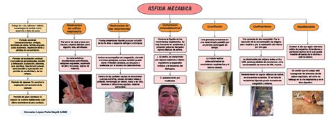 Asfixia Mecanica Asf Ixia Mecanica Griego A Sin Sphizos Latido