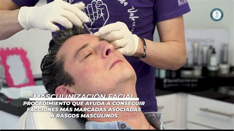 Masculinización Facial Ácido Hialurónico Botox Luce Un Rostro