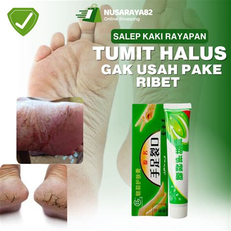 Jual Salep Kaki Rayapan Krim Penghalus Tumit Kaki Pecah Pecah Kasar