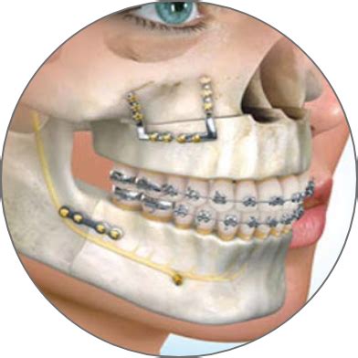 Coyne Oral Surgery Dental Implants Cosmetic Procedures