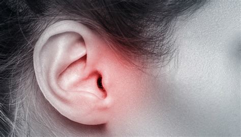 Coceira No Ouvido - Coceira no ouvido pode ser sintoma de psoríase, infecção e mais 4 ...