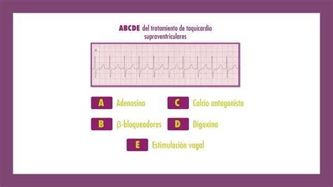 Taquicardia Supraventricular Youtube