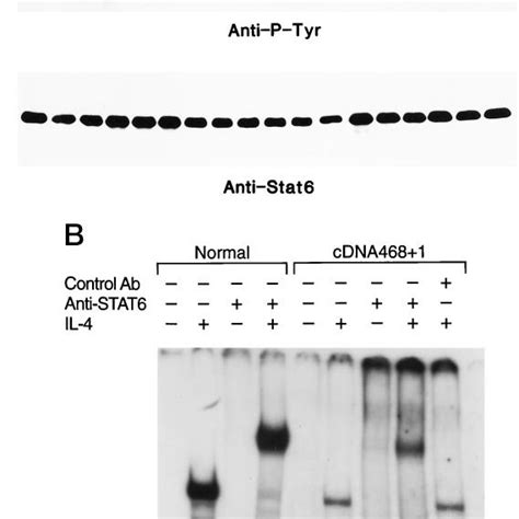 Analysis Of Stat Tyrosine Phosphorylation And Dna Binding Activity