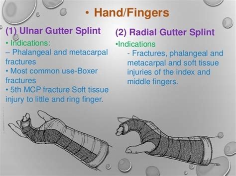 Ulnar Gutter Splint Procedure