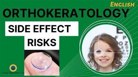 Orthokeratology Side Effects And Risks 2022 English Youtube