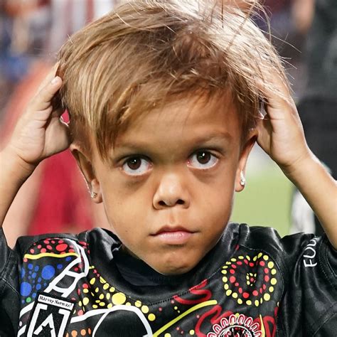 Meet Quaden Bayles Bullied Boy With Dwarfism Cast In Mad Max Film