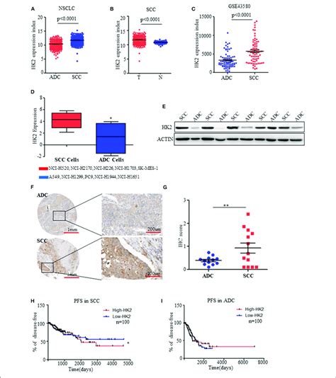 Hk2 Is Highly Expressed In Scc Compared To Adc A Hk2 Expression