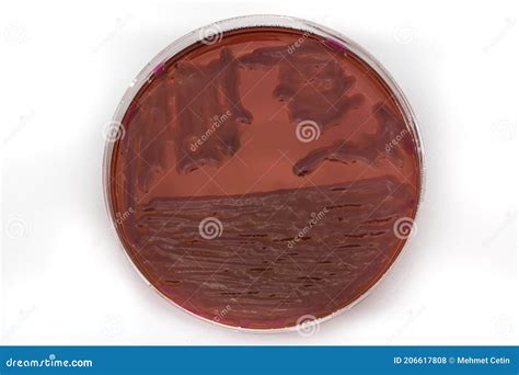 Growing Bacteria In Agar Medium In Microbiology Lab Making Streak In A